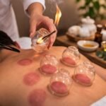 cupping therapy does it hurt